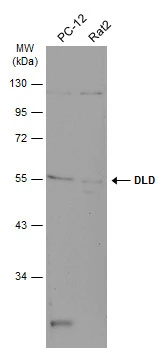 Various whole cell extracts (30 μg) were separated by 10% SDS-PAGE, and the membrane was blotted with DLD antibody [N1N3] (GTX101232) diluted at 1:500. The HRP-conjugated anti-rabbit IgG antibody (GTX213110-01) was used to detect the primary antibody, and the signal was developed with Trident ECL plus-Enhanced.