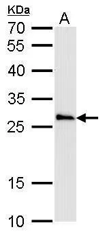 COMT antibody detects COMT protein by Western blot analysis. A. 50 μg mouse spleen lysate/extract 12 % SDS-PAGE COMT antibody (GTX101233) dilution: 1:500