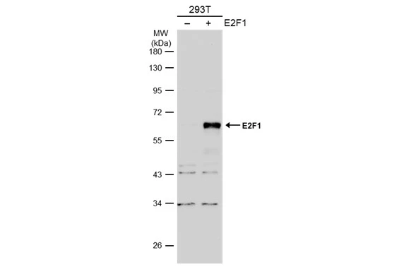 Non-transfected (–) and transfected (+) 293T whole cell extracts (30 μg) were separated by 10% SDS-PAGE, and the membrane was blotted with E2F1 antibody [N1N3] (GTX101235) diluted at 1:500. The HRP-conjugated anti-rabbit IgG antibody (GTX213110-01) was used to detect the primary antibody.