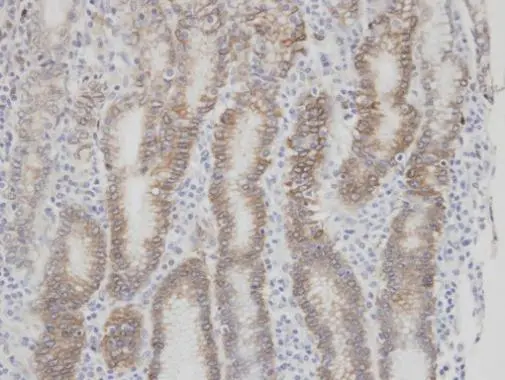 Factor VII antibody [N3C3]