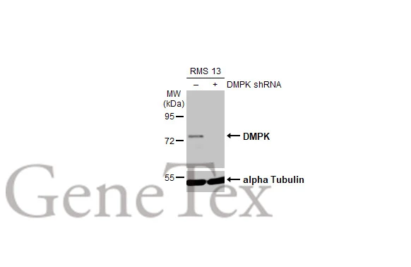 Non-transfected (–) and transfected (+) RMS 13 whole cell extracts (30 μg) were separated by 7.5% SDS-PAGE, and the membrane was blotted with DMPK antibody (GTX101248) diluted at 1:1000. The HRP-conjugated anti-rabbit IgG antibody (GTX213110-01) was used to detect the primary antibody, and the signal was developed with Trident ECL plus-Enhanced.