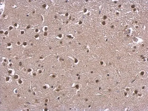 CNPBerry 1.0ml最高品質CBP CRDP CRDH1823 PROTEINDEX™ Ni-Penta™ Agarose 6FF Prepacked Cartridge