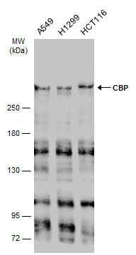 Anti-CBP antibody [C3], C-term (GTX101249) | GeneTex