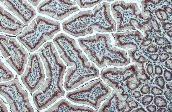 CNPBerry 1.0ml最高品質CBP CRDP CRDH1823 PROTEINDEX™ Ni-Penta™ Agarose 6FF Prepacked Cartridge