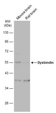 Various tissue extracts (50 μg) were separated by 10% SDS-PAGE, and the membrane was blotted with Dysbindin antibody (GTX101252) diluted at 1:500. The HRP-conjugated anti-rabbit IgG antibody (GTX213110-01) was used to detect the primary antibody, and the signal was developed with Trident ECL plus-Enhanced.
