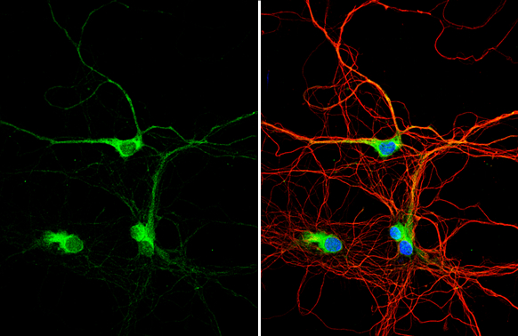 Dysbindin antibody detects Dysbindin protein by immunofluorescent analysis. Sample: DIV9 rat E18 primary hippocampal neuron cells were fixed in 4% paraformaldehyde at RT for 15 min. Green: Dysbindin stained by Dysbindin antibody (GTX101252) diluted at 1:500. Red: beta Tubulin 3/ Tuj1, stained by beta Tubulin 3/ Tuj1 antibody [GT11710] (GTX631836) diluted at 1:500. Blue: Fluoroshield with DAPI (GTX30920).