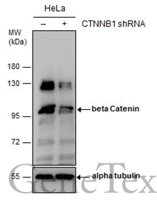 Non-transfected (–) and transfected (+) HeLa whole cell extracts (30 μg) were separated by 7.5% SDS-PAGE, and the membrane was blotted with beta Catenin antibody (GTX101254) diluted at 1:1000.