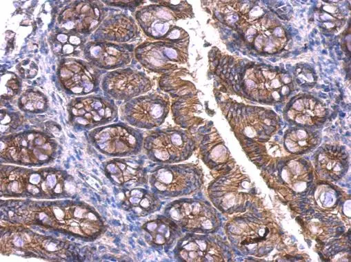 beta Catenin antibody detects beta Catenin protein at membrane on mouse colon by immunohistochemical analysis. Sample: Paraffin-embedded mouse colon. beta Catenin antibody (GTX101254) dilution: 1:500. 
 Antigen Retrieval: Trilogy? (EDTA based, pH 8.0) buffer, 15min