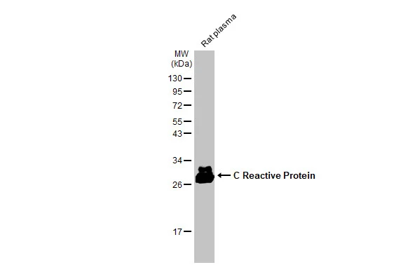 C Reactive Protein antibody [N1C3]