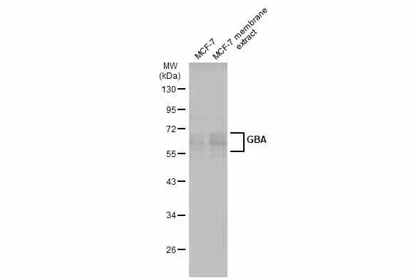 MCF-7 whole cell and membrane extracts (30 μg) were separated by 10% SDS-PAGE, and the membrane was blotted with GBA antibody [C1C3] (GTX101267) diluted at 1:500. The HRP-conjugated anti-rabbit IgG antibody (GTX213110-01) was used to detect the primary antibody.