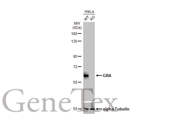 Wild-type (WT) and GBA knockout (KO) HeLa cell extracts (30 μg) were separated by 7.5% SDS-PAGE, and the membrane was blotted with GBA antibody [C1C3] (GTX101267) diluted at 1:500. The HRP-conjugated anti-rabbit IgG antibody (GTX213110-01) was used to detect the primary antibody.