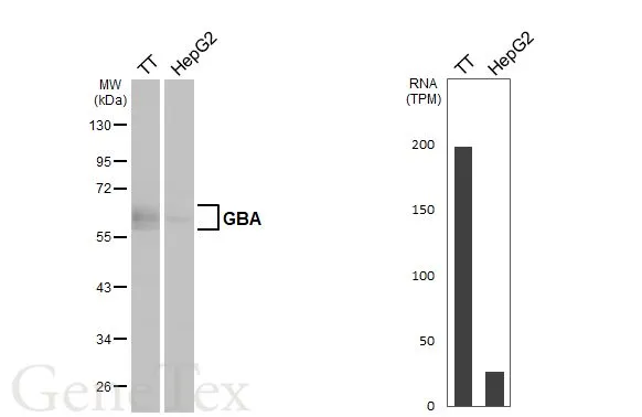 Various whole cell extracts (30 μg) were separated by 10% SDS-PAGE, and the membrane was blotted with GBA antibody [C1C3] (GTX101267) diluted at 1:1000. The HRP-conjugated anti-rabbit IgG antibody (GTX213110-01) was used to detect the primary antibody. Corresponding RNA expression data for the same cell lines are based on Human Protein Atlas program.