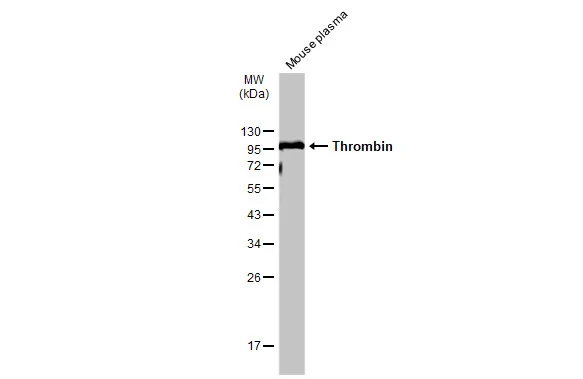 Mouse plasma (50 μg) was separated by 12% SDS-PAGE, and the membrane was blotted with Thrombin antibody (GTX101270) diluted at 1:1000. The HRP-conjugated anti-rabbit IgG antibody (GTX213110-01) was used to detect the primary antibody.