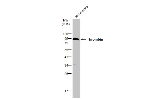 Rat plasma (50 μg) was separated by 12% SDS-PAGE, and the membrane was blotted with Thrombin antibody (GTX101270) diluted at 1:1000. The HRP-conjugated anti-rabbit IgG antibody (GTX213110-01) was used to detect the primary antibody.