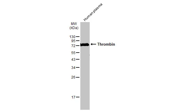 Human plasma (30 μg) was separated by 12% SDS-PAGE, and the membrane was blotted with Thrombin antibody (GTX101270) diluted at 1:1000. The HRP-conjugated anti-rabbit IgG antibody (GTX213110-01) was used to detect the primary antibody.