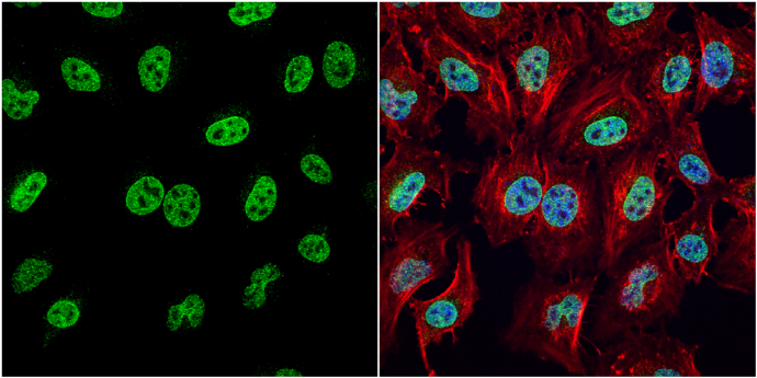 Various whole cell extracts (30 ug) were separated by 12% SDS-PAGE,and the membrane was blotted with HMGB1 antibody (GTX101277) diluted at 1:3000. The HRP-conjugated anti-rabbit IgG antibody (GTX213110-01) was used to detect the primary antibody.
