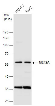 Various whole cell extracts (30 μg) were separated by 10% SDS-PAGE, and the membrane was blotted with MEF2A antibody [C2C3], C-term (GTX101286) diluted at 1:500.