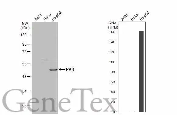 Various whole cell extracts (30 μg) were separated by 10% SDS-PAGE, and the membrane was blotted with PAH antibody [N1C2] (GTX101290) diluted at 1:500. The HRP-conjugated anti-rabbit IgG antibody (GTX213110-01) was used to detect the primary antibody. Corresponding RNA expression data for the same cell lines are based on Human Protein Atlas program.