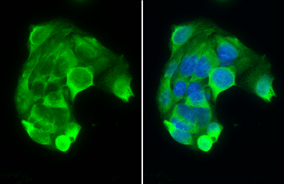 PAH antibody [N1C2] detects PAH protein at cytoplasm by immunofluorescent analysis. Sample: HepG2 cells were fixed in 4% paraformaldehyde at RT for 15 min. Green: PAH stained by PAH antibody [N1C2] (GTX101290) diluted at 1:500. Blue: Fluoroshield with DAPI (GTX30920).