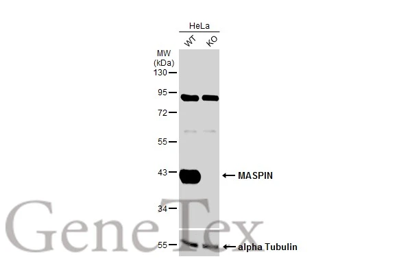 Wild-type (WT) and MASPIN knockout (KO) HeLa cell extracts (30 μg) were separated by 10% SDS-PAGE, and the membrane was blotted with MASPIN antibody [N3C3] (GTX101292) diluted at 1:500. The HRP-conjugated anti-rabbit IgG antibody (GTX213110-01) was used to detect the primary antibody.