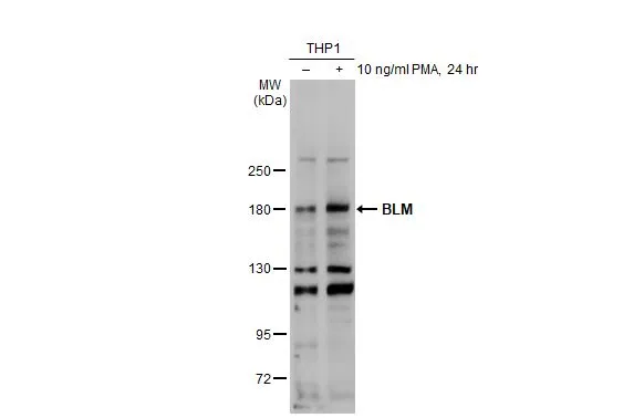 Untreated (–) and treated (+) THP-1 cells were untreated or treated with 10 ng/ml PMA for 24 hrs (30 μg) were separated by 5% SDS-PAGE, and the membrane was blotted with BLM antibody [C3], C-term (GTX101303) diluted at 1:1000. The HRP-conjugated anti-rabbit IgG antibody (GTX213110-01) was used to detect the primary antibody, and the signal was developed with Trident ECL plus-Enhanced.