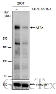 Non-transfected (–) and transfected (+) 293T whole cell extracts (30 μg) were separated by 5% SDS-PAGE, and the membrane was blotted with ATRX antibody [C3], C-term (GTX101310) diluted at 1:2000. The HRP-conjugated anti-rabbit IgG antibody (GTX213110-01) was used to detect the primary antibody.