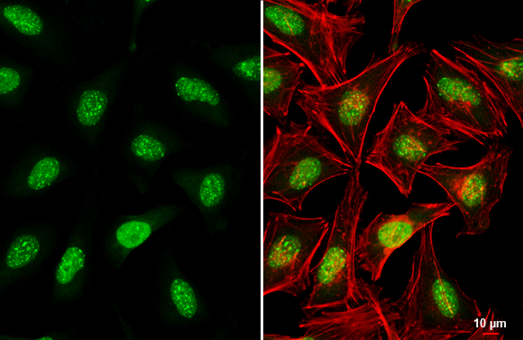 ATRX antibody [C3], C-term detects ATRX protein at nucleus by immunofluorescent analysis. Sample: HeLa cells were fixed in 4% paraformaldehyde at RT for 15 min. Green: ATRX stained by ATRX antibody [C3], C-term (GTX101310) diluted at 1:1000. Red: phalloidin, a cytoskeleton marker, diluted at 1:200. Scale bar= 10 μm.