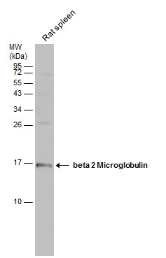 Rat tissue extract (50 μg) was separated by 15% SDS-PAGE, and the membrane was blotted with beta 2 Microglobulin antibody [N1C3] (GTX101314) diluted at 1:500.