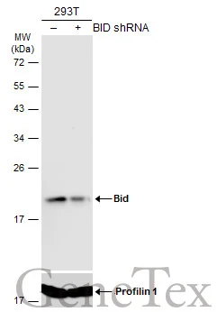 Non-transfected (–) and transfected (+) 293T whole cell extracts (60 μg) were separated by 12% SDS-PAGE, and the membrane was blotted with Bid antibody [N1C3] (GTX101323) diluted at 1:5000. The HRP-conjugated anti-rabbit IgG antibody (GTX213110-01) was used to detect the primary antibody.