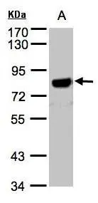 Various whole cell extracts (30 ug) were separated by 7.5% SDS-PAGE,and the membrane was blotted with APP antibody [C2C3],C-term (GTX101336) diluted at 1:500.