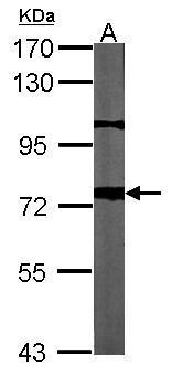 Various whole cell extracts (30 ug) were separated by 7.5% SDS-PAGE,and the membrane was blotted with APP antibody [C2C3],C-term (GTX101336) diluted at 1:500.