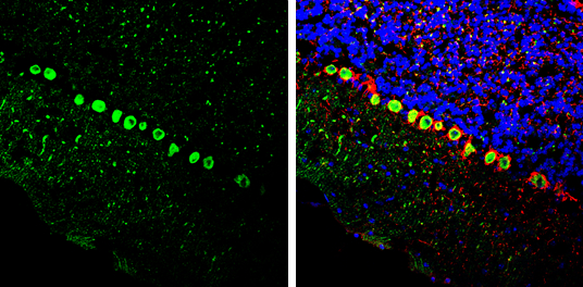 BCL6 antibody [N2C1], Internal