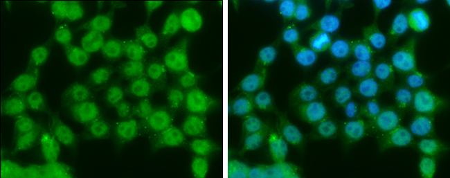 Ataxin 3 antibody detects Ataxin 3 protein at cytoplasm and nucleus by immunofluorescent analysis. Sample: 293T cells were fixed in 4% paraformaldehyde at RT for 15 min. Green: Ataxin 3 protein stained by Ataxin 3 antibody (GTX101343) diluted at 1:250. Blue: Hoechst 33342 staining.