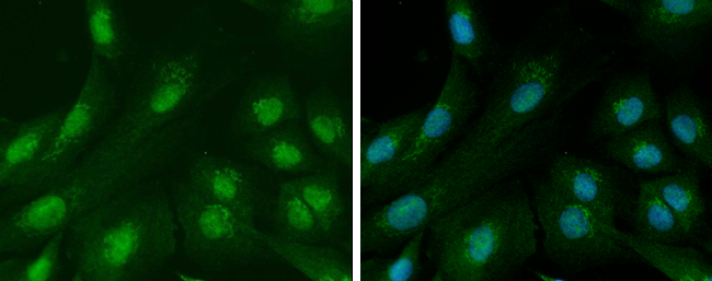 Ataxin 3 antibody detects Ataxin 3 protein at cytoplasm and nucleus by immunofluorescent analysis. Sample: SK-N-SH cells were fixed in 4% paraformaldehyde at RT for 15 min. Green: Ataxin 3 protein stained by Ataxin 3 antibody (GTX101343) diluted at 1:250. Blue: Hoechst 33342 staining.