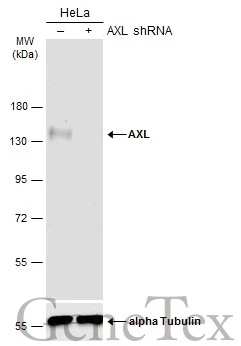 Non-transfected (–) and transfected (+) HeLa whole cell extracts (60 μg) were separated by 7.5% SDS-PAGE, and the membrane was blotted with AXL antibody [C2C3], C-term (GTX101345) diluted at 1:500. The HRP-conjugated anti-rabbit IgG antibody (GTX213110-01) was used to detect the primary antibody.