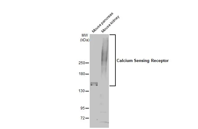 Various tissue extracts (50 μg) were separated by 5% SDS-PAGE, and the membrane was blotted with Calcium Sensing Receptor antibody (GTX101348) diluted at 1:500. The HRP-conjugated anti-rabbit IgG antibody (GTX213110-01) was used to detect the primary antibody.
