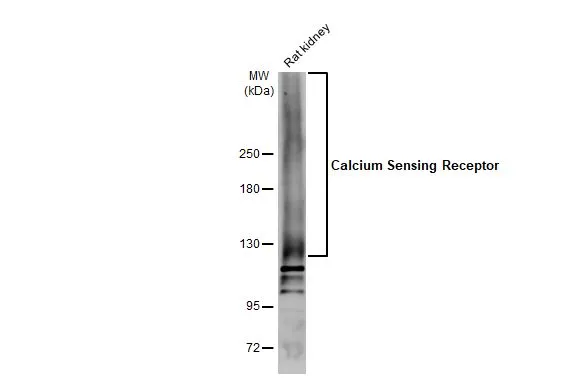 Rat tissue extract (50 μg) was separated by 5% SDS-PAGE, and the membrane was blotted with Calcium Sensing Receptor antibody (GTX101348) diluted at 1:500. The HRP-conjugated anti-rabbit IgG antibody (GTX213110-01) was used to detect the primary antibody.