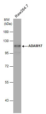 Whole cell extract (30 μg) was separated by 7.5% SDS-PAGE, and the membrane was blotted with ADAM17 antibody [C2C3], C-term (GTX101358) diluted at 1:500. The HRP-conjugated anti-rabbit IgG antibody (GTX213110-01) was used to detect the primary antibody.