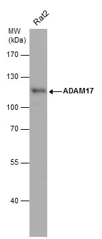 Whole cell extract (30 μg) was separated by 7.5% SDS-PAGE, and the membrane was blotted with ADAM17 antibody [C2C3], C-term (GTX101358) diluted at 1:500. The HRP-conjugated anti-rabbit IgG antibody (GTX213110-01) was used to detect the primary antibody.