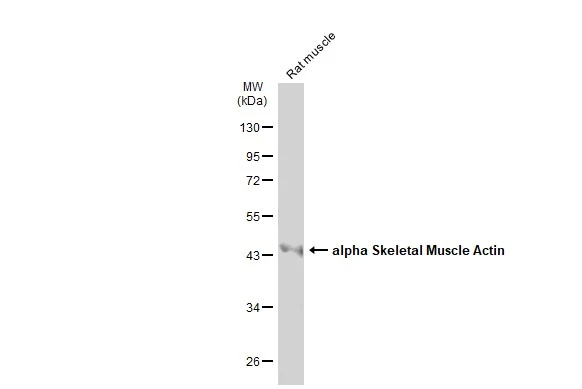 Rat tissue extract (50 μg) was separated by 10% SDS-PAGE, and the membrane was blotted with alpha Skeletal Muscle Actin antibody (GTX101362) diluted at 1:1000. The HRP-conjugated anti-rabbit IgG antibody (GTX213110-01) was used to detect the primary antibody.