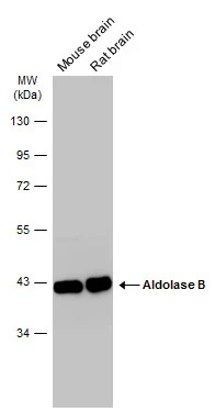 Various tissue extracts (50 μg) were separated by 10% SDS-PAGE, and the membrane was blotted with Aldolase B antibody (GTX101363) diluted at 1:1000. The HRP-conjugated anti-rabbit IgG antibody (GTX213110-01) was used to detect the primary antibody.