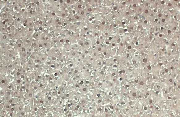 Adenosine kinase antibody detects ADK protein at cytoplasm and nucleus by immunohistochemical analysis. Sample: Paraffin-embedded mouse liver. ADK stained by Adenosine kinase antibody (GTX101385) diluted at 1:500. Antigen Retrieval: Citrate buffer, pH 6.0, 15 min