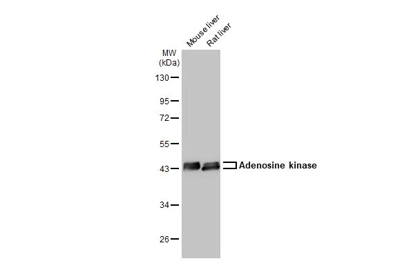 Various tissue extracts (50 μg) were separated by 10% SDS-PAGE, and the membrane was blotted with Adenosine kinase antibody (GTX101385) diluted at 1:1000. The HRP-conjugated anti-rabbit IgG antibody (GTX213110-01) was used to detect the primary antibody.