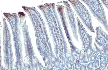 Adenosine Deaminase antibody detects Adenosine Deaminase protein at cytoplasm and nucleus by immunohistochemical analysis. Sample: Paraffin-embedded mouse intestine. Adenosine Deaminase stained by Adenosine Deaminase antibody (GTX101390) diluted at 1:500. Antigen Retrieval: Citrate buffer, pH 6.0, 15 min