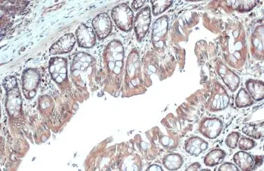 Adenosine Deaminase antibody detects Adenosine Deaminase protein at cytoplasm by immunohistochemical analysis. Sample: Paraffin-embedded rat colon. Adenosine Deaminase stained by Adenosine Deaminase antibody (GTX101390) diluted at 1:500. Antigen Retrieval: Citrate buffer, pH 6.0, 15 min