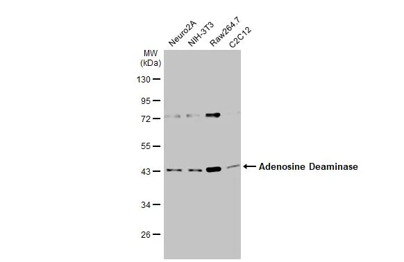 Various whole cell extracts (30 μg) were separated by 10% SDS-PAGE, and the membrane was blotted with Adenosine Deaminase antibody (GTX101390) diluted at 1:1000. The HRP-conjugated anti-rabbit IgG antibody (GTX213110-01) was used to detect the primary antibody.