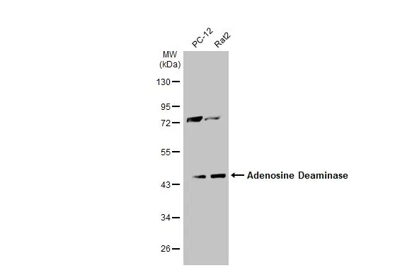 Various whole cell extracts (30 μg) were separated by 10% SDS-PAGE, and the membrane was blotted with Adenosine Deaminase antibody (GTX101390) diluted at 1:1000. The HRP-conjugated anti-rabbit IgG antibody (GTX213110-01) was used to detect the primary antibody.