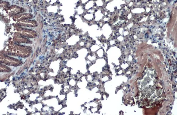 Anti-ACE2 antibody [N1N2], N-term (GTX101395) | GeneTex