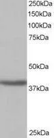 WB analysis of human kidney lysate using GTX10140 SIRT4 antibody. Dilution : 1microg/ml Loading : 35microg protein in RIPA buffer WB analysis of human kidney lysate using GTX10140 SIRT4 antibody. Dilution : 1microg/ml Loading : 35microg protein in RIPA buffer