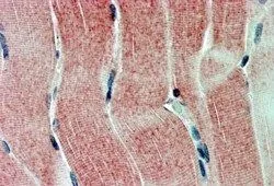 IHC-P analysis of human skeletal muscle using GTX10140 SIRT4 antibody. Antigen retrieval : citrate buffer pH 6 Dilution : 2.5microg/ml